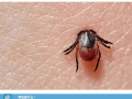 隨州市中心醫(yī)院提醒：小小蜱蟲需警惕！——發(fā)熱伴血小板減少綜合征科普知識